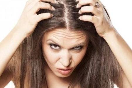 头皮屑多是什么原因