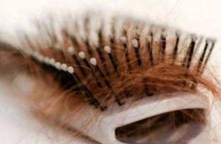 掉发严重是什么原因