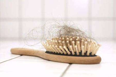 掉头发怎么办