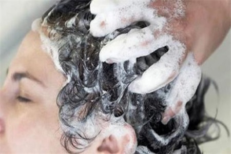 头皮屑多是什么原因头