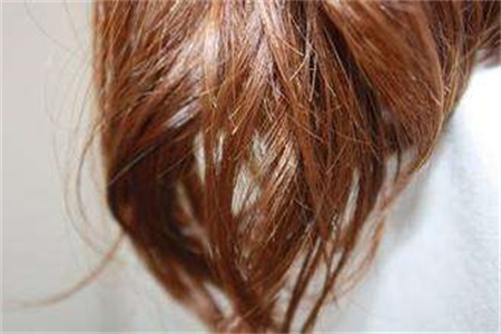 头发干枯毛躁怎么办