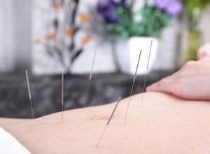 针灸减肥有效吗？全面了解针灸减肥